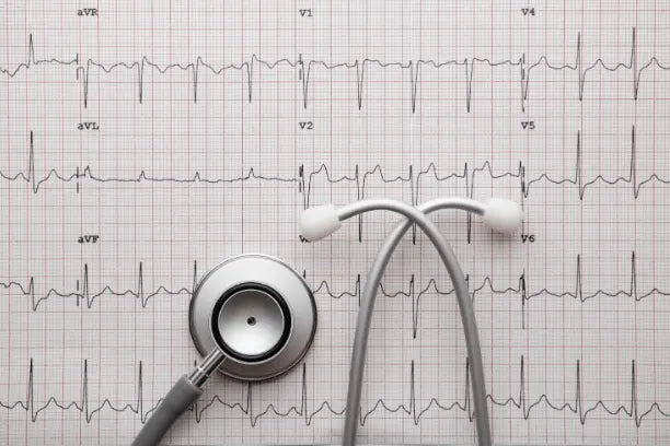 EKG-Uhren-im-Vergleich-Können-Smartwatches-eine-echte-Gesundheits-Überwachung-bieten Kardena
